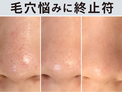ハダイ(HADAY)の写真