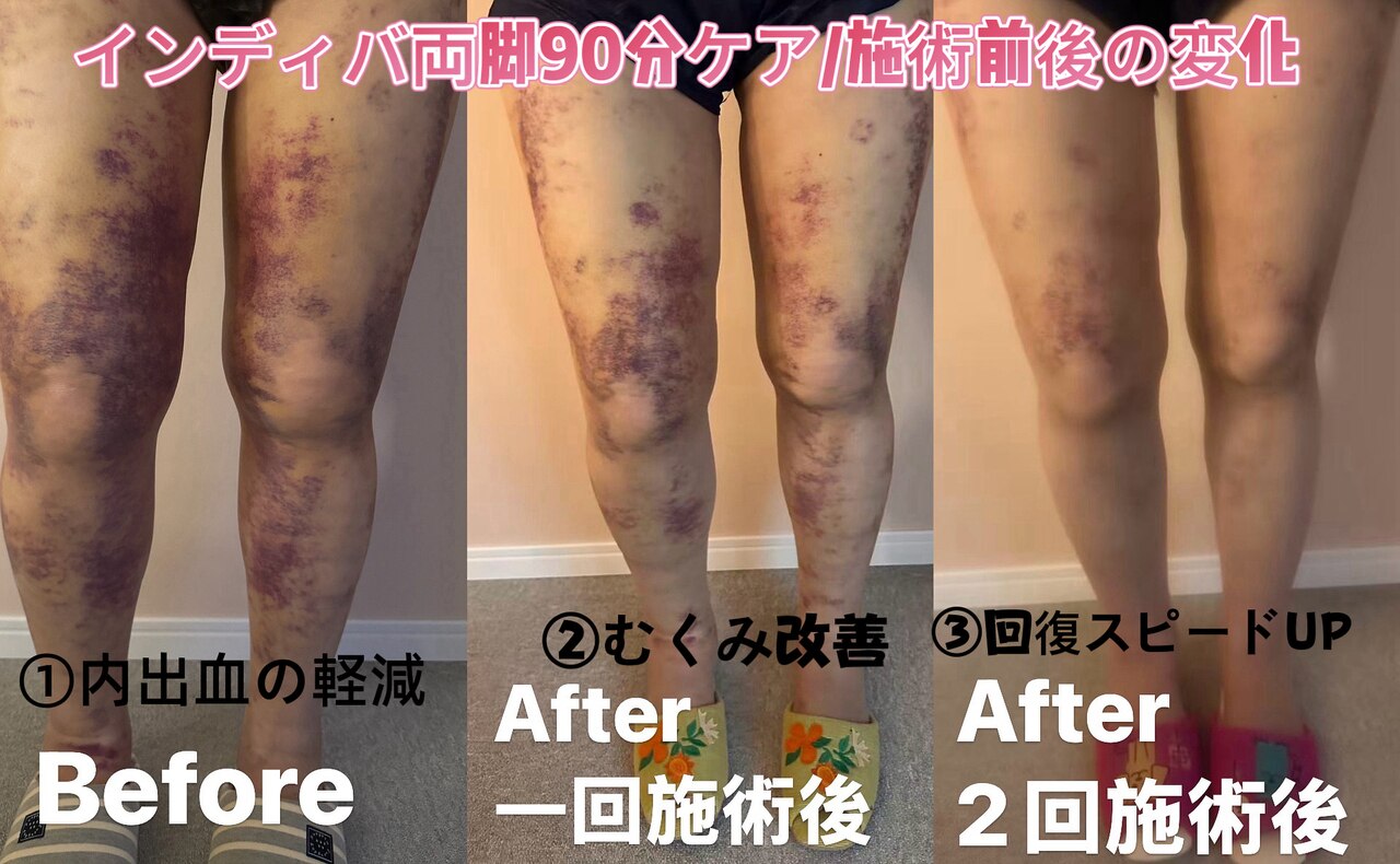 中央区でEMSが人気のエステサロン｜ホットペッパービューティー