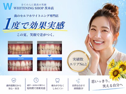 ホワイトニングショップ 茨木店の写真