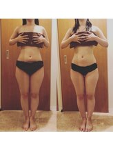 ヴィエーゾ(VIESO)/ハイパーナイフ×ハンドリンパ