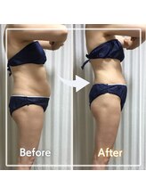 レイビス 盛岡店(RAYVIS)/ハミ肉、贅肉撃退痩身！