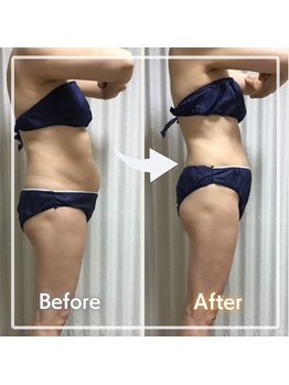 レイビス 盛岡店(RAYVIS)/ハミ肉、贅肉撃退痩身!