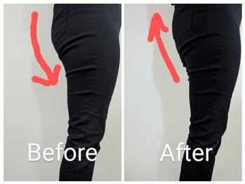 シェイプアップサロン/【Before&After】