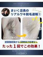 ファスモ(FASMO)/1回での効果