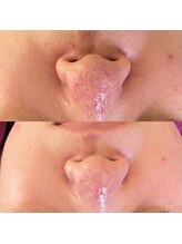 リラクゼーションの森/