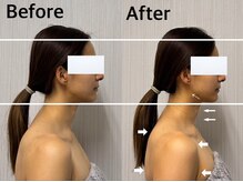 ベール(BEHL)/コルギのBefore After