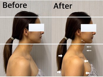 ベール(BEHL)/コルギのBefore After