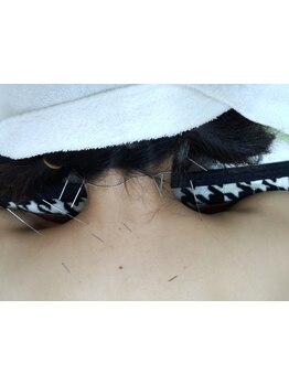 首・肩のつらさを改善したい