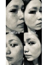 スパ ザ 睡(SPA The Sui)/スキンケアだけで驚きの変化