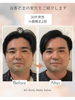 アンドユー(&U)/