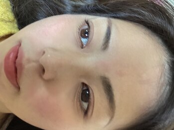 ソラ(sora)/月に1度の毛穴洗浄で素肌綺麗♪