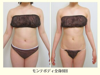 リクラ(Reclat)/モンテボディ全身8回