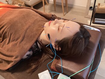 ハリファ鍼灸院 横浜関内院(HariFa鍼灸院)/美容施術・美容鍼