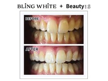 ブリングホワイト プラス ビューティーイズ(BLING WHITE + Beauty iS)の雰囲気（美肌小顔×ボディケア×脱毛×セルフホワイトニング×水素吸入）