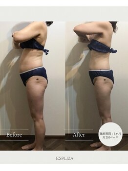 エスプライザ 横浜駅前店/ぼっこりお腹もスッキリ!