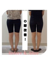 スタイルラボ高松/O脚矯正の効果♪