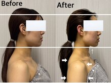 ベール(BEHL)/コルギのBefore After