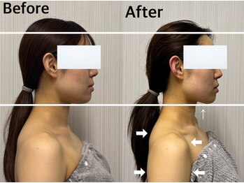 ベール(BEHL)/コルギのBefore After