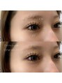 アイラ 甲府昭和店(EYELA)&nbsp;今人気のリフエクでぱっちりとボリュームのある印象に★