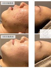 ラヴィオーラ 神戸三宮店(La Viora) La Viora