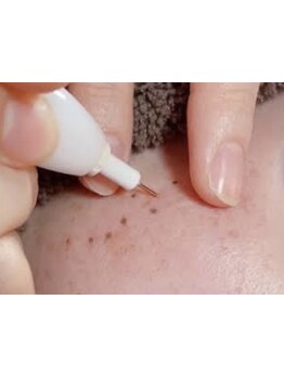 シミしわ改善！予防ケア