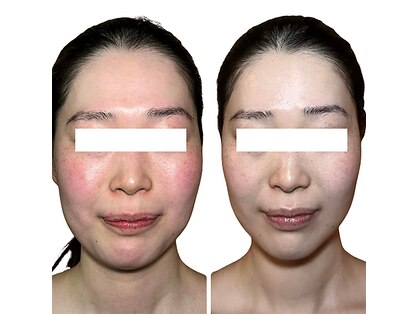 ボディケアサロン アイリフ(airef)の写真