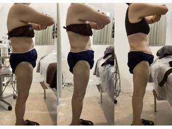 ルボン(RUBON)/姿勢矯正とお腹の脂肪分解