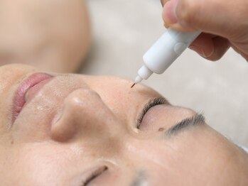 サロンルナ(Salon Luna)/シミにピンポイントでアプローチ