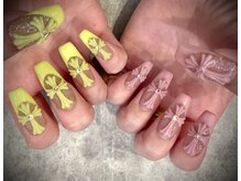 コトレース(KOTRACE)