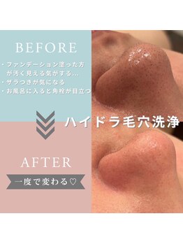 ブリック(BLICK)の写真/お手軽に黒ずみ撃退☆【毛穴洗浄】 毛穴レスなつるつる肌に！メンズにも大人気！