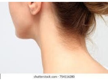 ヒカリ(Hikari)/【女性】背中・うなじセット