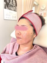 リフティングラボ(LIFTING LAB)/水玉リフティング＆ビーナス