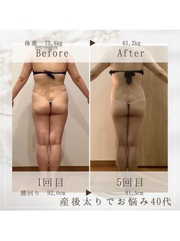 フローラ 自由が丘(Flora)/★結果出し★