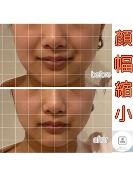 コルギと小顔矯正サロン ウンジョルノ フェリーチェ(un giorno felice)/小顔コルギ1回