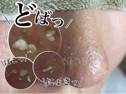 セミル(SEMIRU)の写真