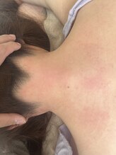 レイワックススタジオ(Lei wax studio)/うなじワックス脱毛