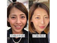 シャイニー(Shiny)の雰囲気（本気の肌質改善！人生最高のつや肌へ。REVI陶肌トリートメント）