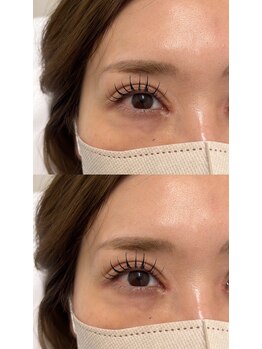 アイビューティートロント(i beauty Toronto)/まつパー/脱毛/HBL/パリジェンヌ