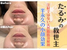 ココロ(COCORO)