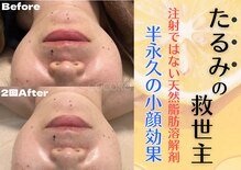 ココロ(COCORO)