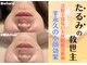 ココロ(COCORO)の写真