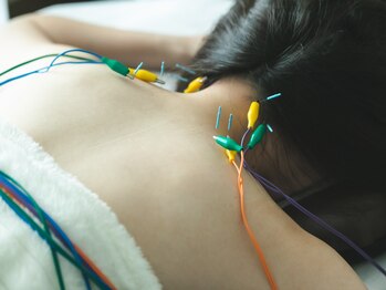 ハリスト(HARIST)の写真/《納得の技術力》巻き肩/頭痛/腰痛などお悩みの原因に◎ストレスを軽減し、カラダのバランスを整えます♪