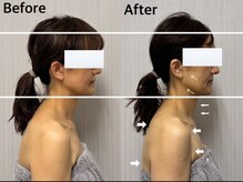 ベール(BEHL)/コルギのBefore After