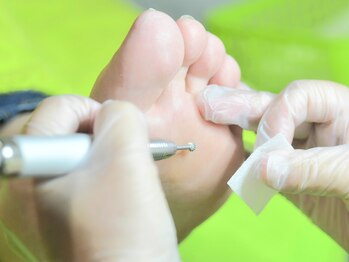 ニコルル 高崎パルクハナミズキ店(Nicolulu)の写真/足裏・爪・筋肉までトータルケア！技術力の高い施術で、健康も美しさも叶えます☆足トラブルお任せ下さい◎