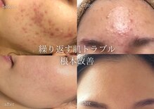 リアルナ(REALUNA)