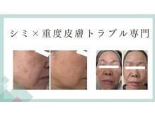 シャルナ(charna)