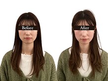整体と美容鍼 無名/Before＆After【心斎橋/南船場】