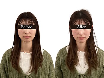 整体と美容鍼 無名/Before&After【心斎橋/南船場】