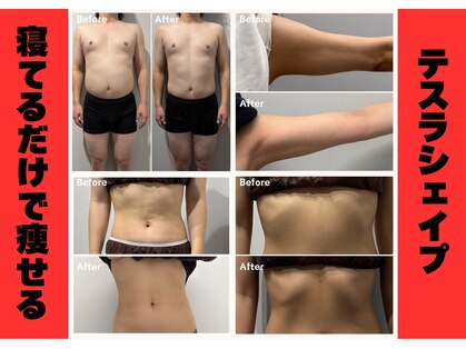 アーヒル(A”-HILU)の写真