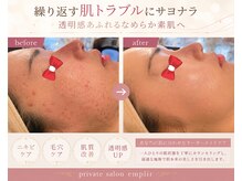 アンプリール(emplir)の雰囲気（【ドクターピュアラボ】認定サロン肌質改善、たるみ、しわ）
